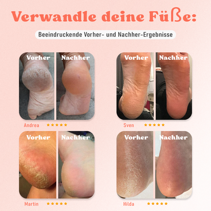 Suggila™ – Salonqualität für Deine Füße